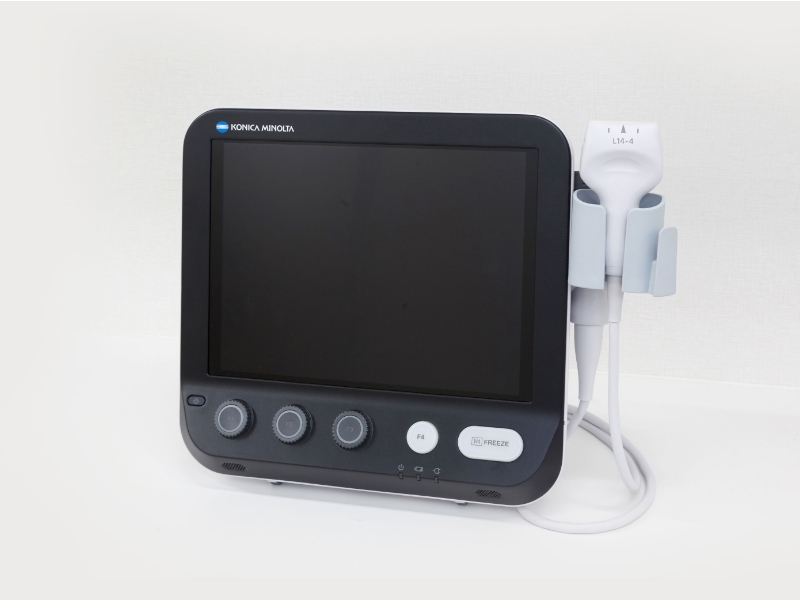 超音波診断装置